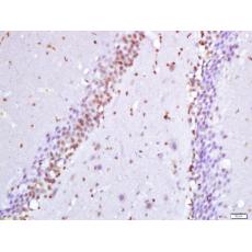 Anti-Hes5 antibody