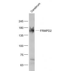 Anti-FRMPD2 antibody