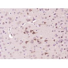 Anti-FSD1 antibody
