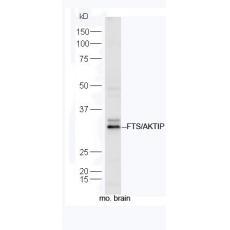 Anti-FTS/AKTIP antibody