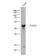 Anti-FUCA1 antibody