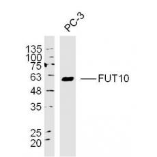 Anti-FUT10 antibody