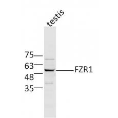 Anti-FZR1 antibody