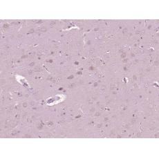 Anti-G21 protein/NPR2L antibody