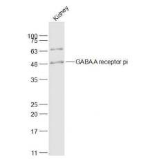 Anti-GABA A receptor pi antibody