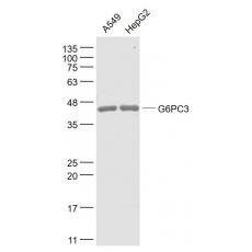 Anti-G6PC3 antibody