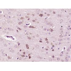 Anti-GABRB2 antibody