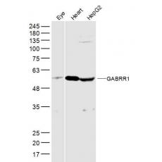 Anti-GABRR1 antibody