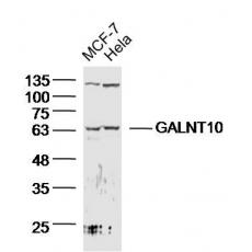 Anti-GALNT10 antibody