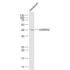Anti-GABRA2 antibody