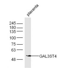 Anti-GAL3ST4 antibody