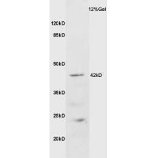 Anti-GALR2 antibody
