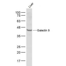 Anti-Galectin 9 antibody