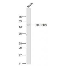 Anti-GAPDHS antibody