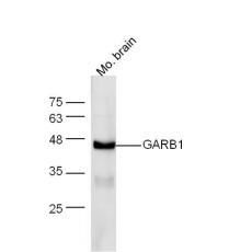 Anti-GARB1 antibody