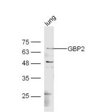 Anti-GBP2 antibody