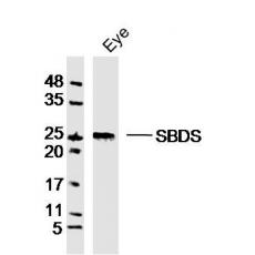 Anti-GCAP1 antibody