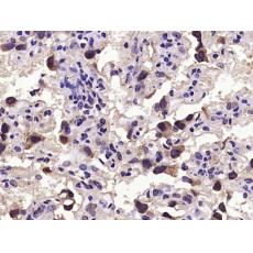 Anti-GDF15 antibody