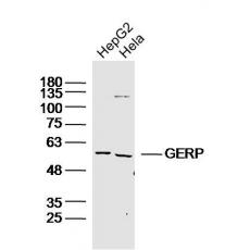 Anti-GERP antibody