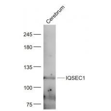 Anti-GEP100/IQSEC1 antibody