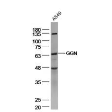 Anti-GGN antibody