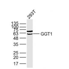 Anti-GGT1 antibody