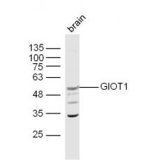Anti-GIOT1 antibody