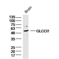 Anti-GLCCI1 antibody