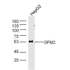 Anti-GFM2 antibody