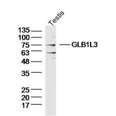 Anti-GLB1L3 antibody