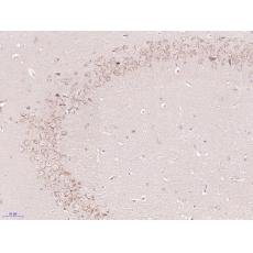 Anti-Gliomedin antibody