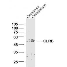 Anti-GLRB antibody