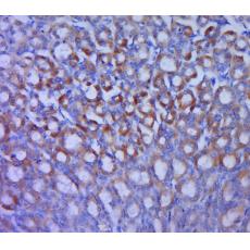 Anti-GLUT12 antibody