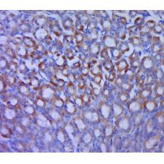 Anti-GLUT12 antibody