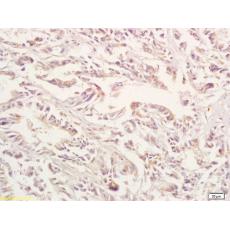 Anti-GPA33 antibody