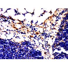 Anti-GPCR EX33 antibody