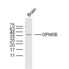 Anti-GPM6B antibody