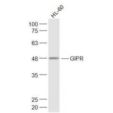 Anti-GIPR antibody