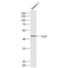 Anti-GLK antibody