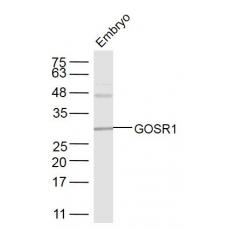 Anti-GOLGA6L4 antibody