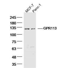 Anti-GPR113 antibody