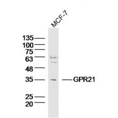 Anti-GPR21 antibody