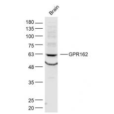 Anti-GPR162 antibody