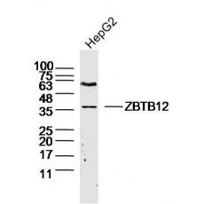 Anti-GPR31 antibody