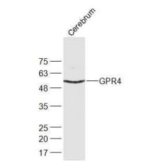 Anti-GPR19/GPR4 antibody
