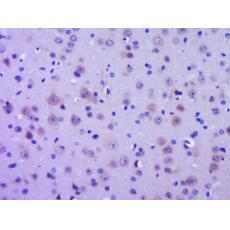 Anti-GPR30 antibody