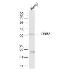 Anti-GPR55 antibody