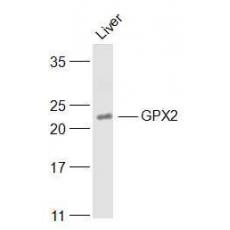 Anti-GPX2 antibody