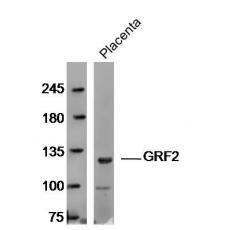 Anti-GRF2 antibody