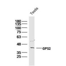 Anti-GPS2 antibody